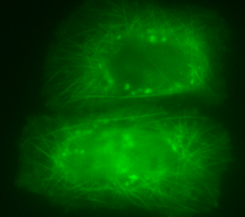 Células vivas com marcação fluorescente verde assinalando microtúbulos e agregados da proteína Tau (pontos verdes)