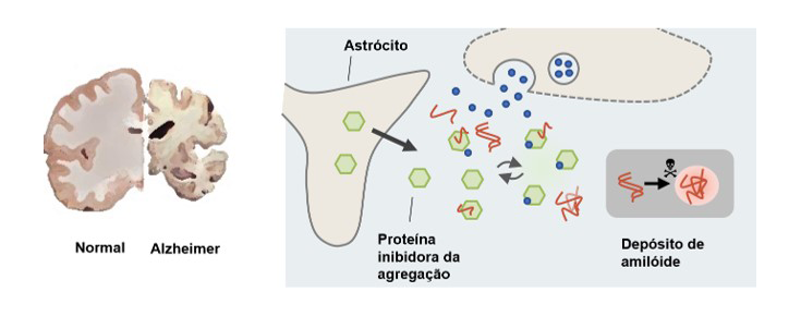 Agregação amilóide na doença de Alzheimer e mecanismos neuronais de proteção